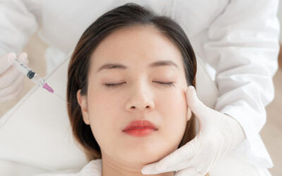 ฉีดฟิลเลอร์ Juvederm ตรงไหนดี? รวมทุกจุดปรับรูปหน้าให้เรียวสวย