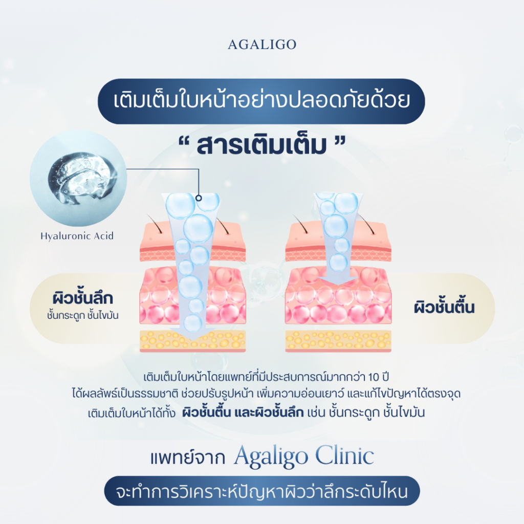 ชั้นผิวฉีดฟิลเลอร์