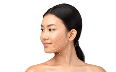 ร้อยไหมยกกระชับหน้า: เคล็ดลับคืนความอ่อนเยาว์สำหรับวัย 50+