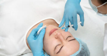 close-up-woman-lip-filler-procedure - over-filler