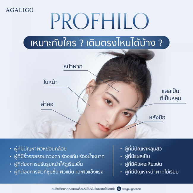 Profhilo