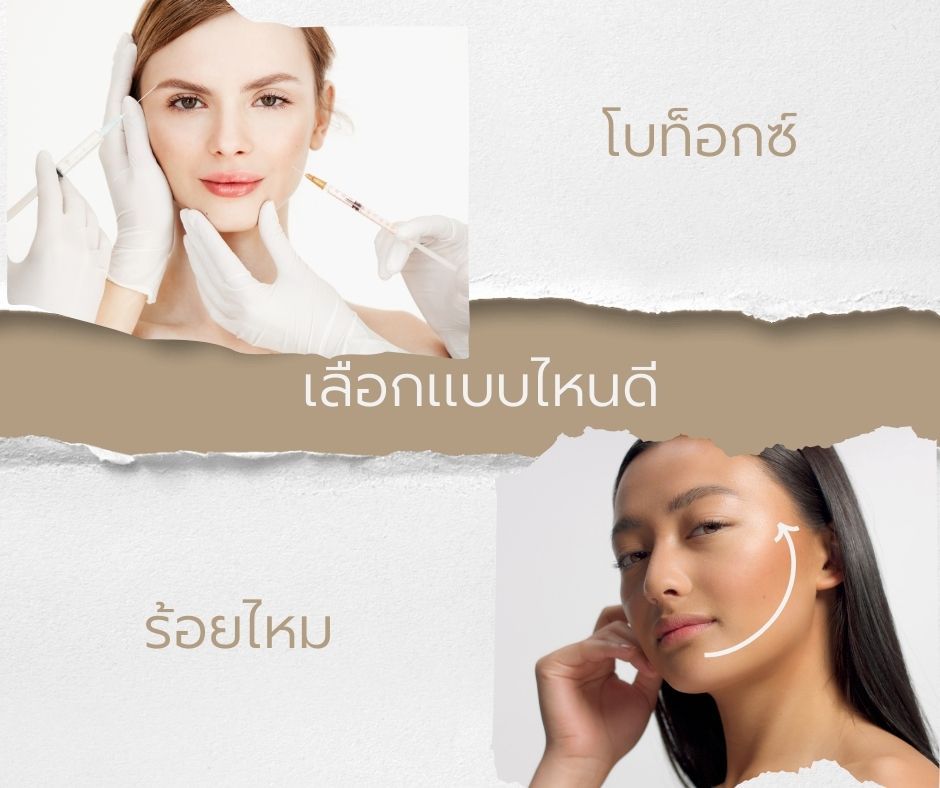 โบท็อกซ์ ร้อยไหม