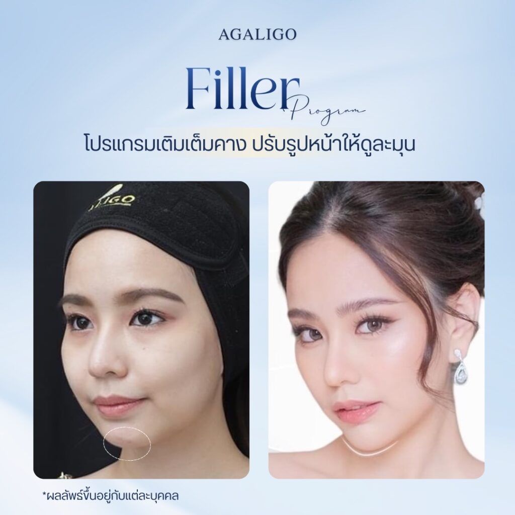 FillerReview1