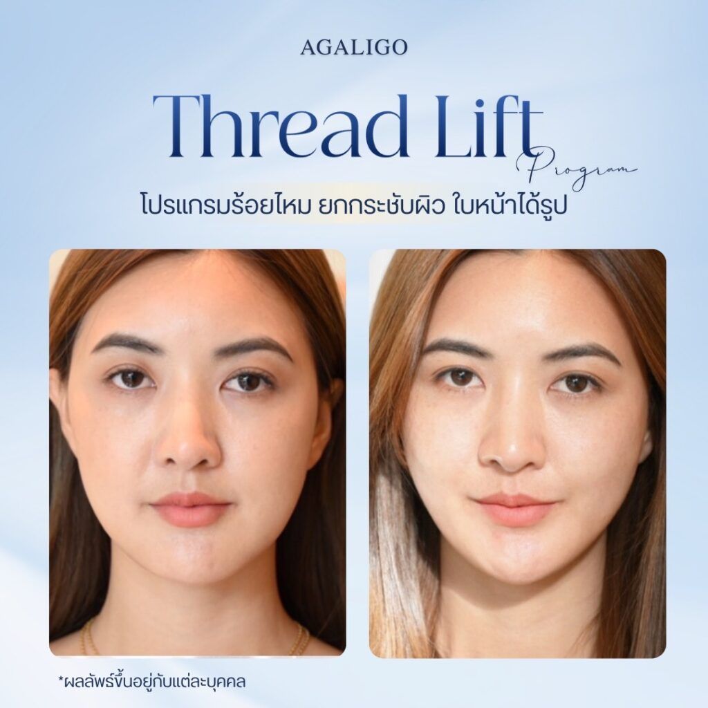 ร้อยไหม รีวิว
