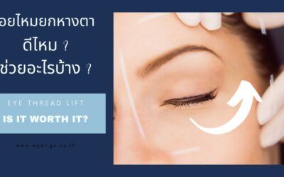 ร้อยไหมยกหางตา เพิ่มความเฉี่ยวคม แก้ปัญหาตาตก ดีไหม?