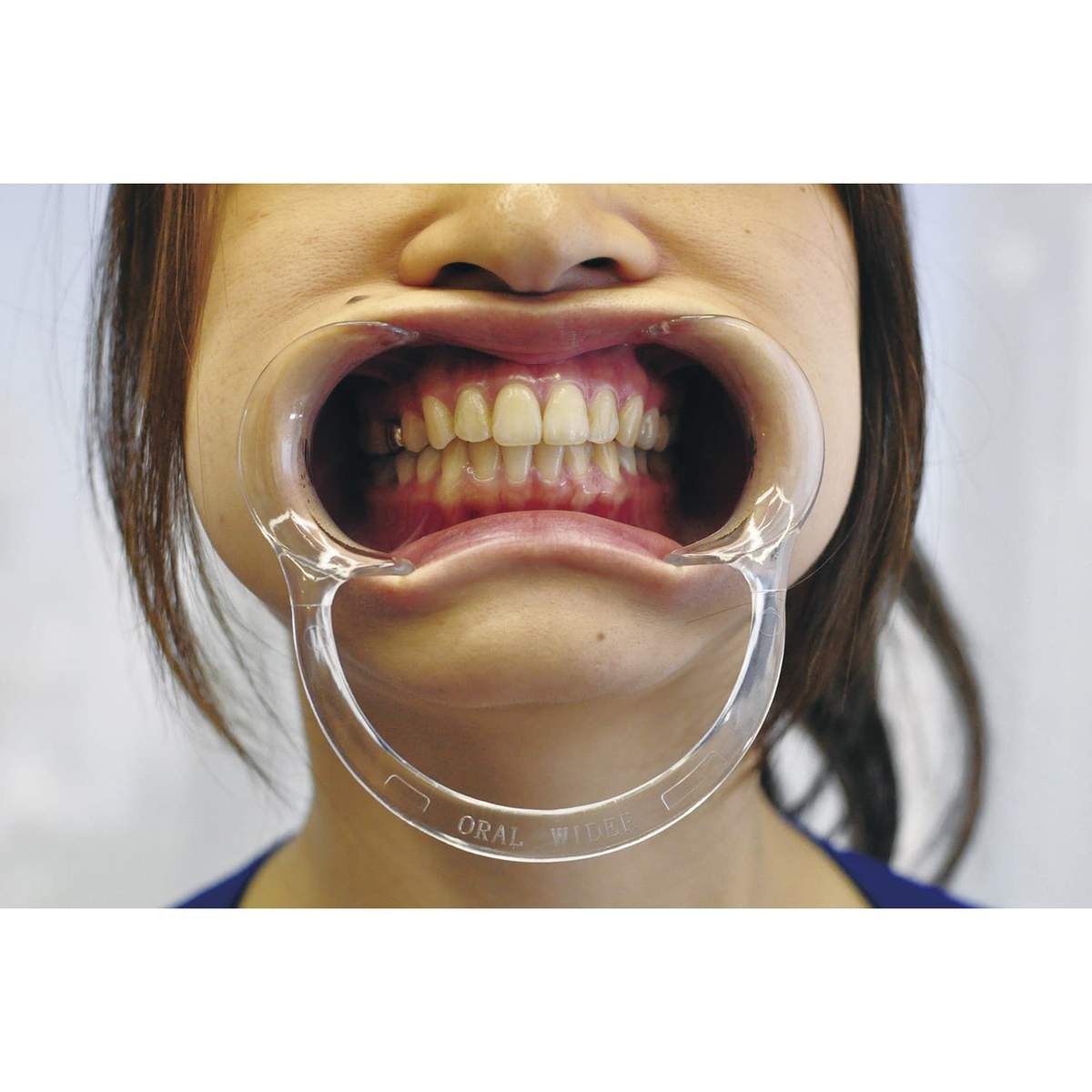 オーラルワイダー(ハード) ハード 開口補助具 23-2636-00 ザイコア