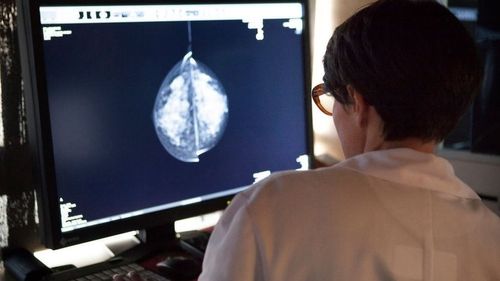 دراسة تكشف قدرة الذّكاء الاصطناعي على مساعدة أطباء الأشعة في اكتشاف السّرطان
