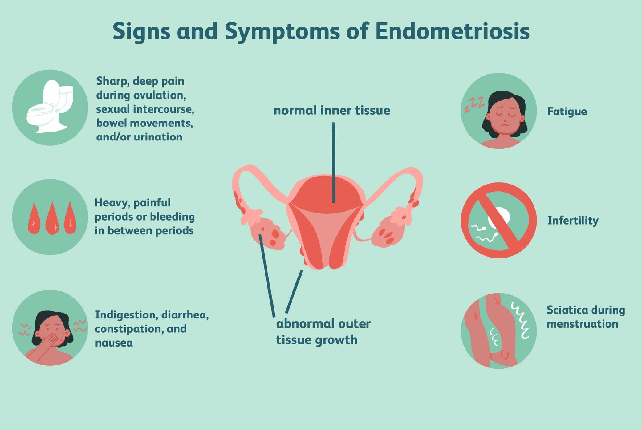 https://ik.imagekit.io/d7t01fhx2/Ovum_Hospitals/Blogs/Endometriosis%20symptoms%20and%20treatment-01.jpg?updatedAt=1698650199303