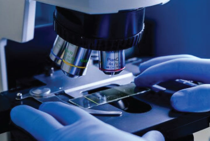 Pharmacy Lab Testing & Image Diagnostics Bangalore - Ovum Hospitals