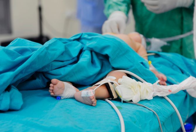 Neonatal Care In Bangalore - Ovum Hospitals