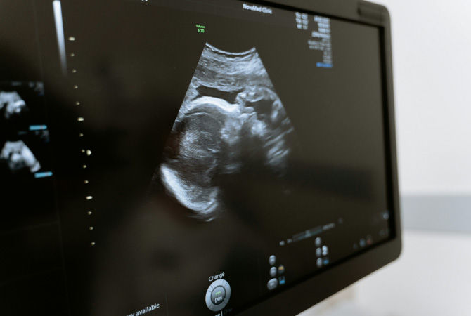 Sonography in Pregnancy - Ovum Hospitals