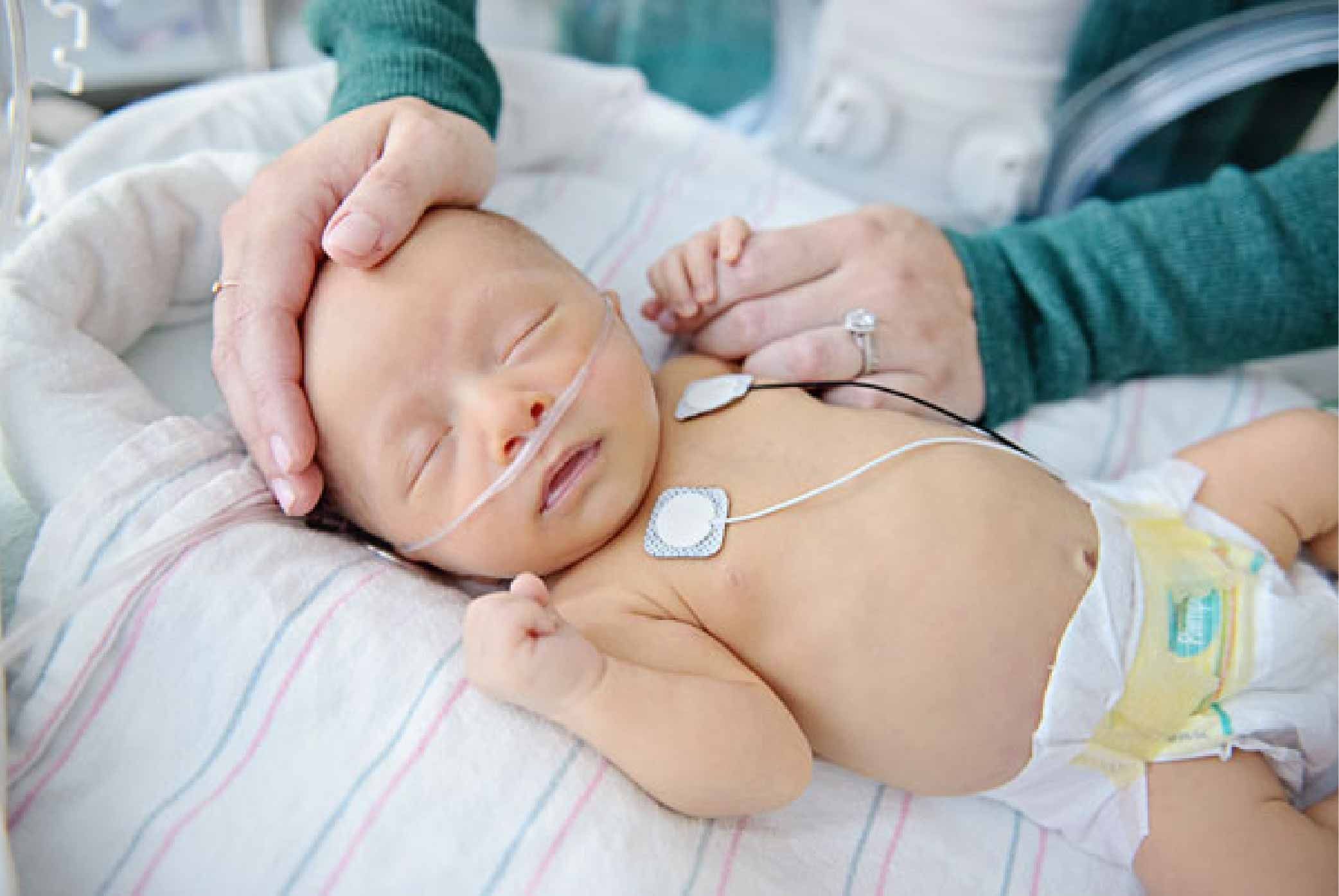 Common conditions treated in NICU