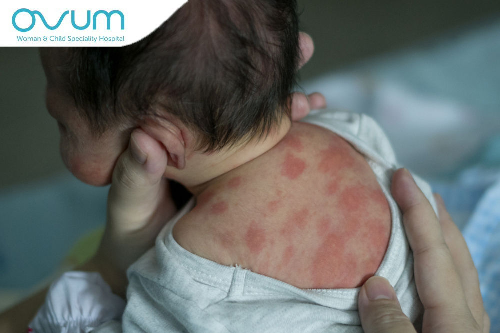 Common Skin Problems In Children
