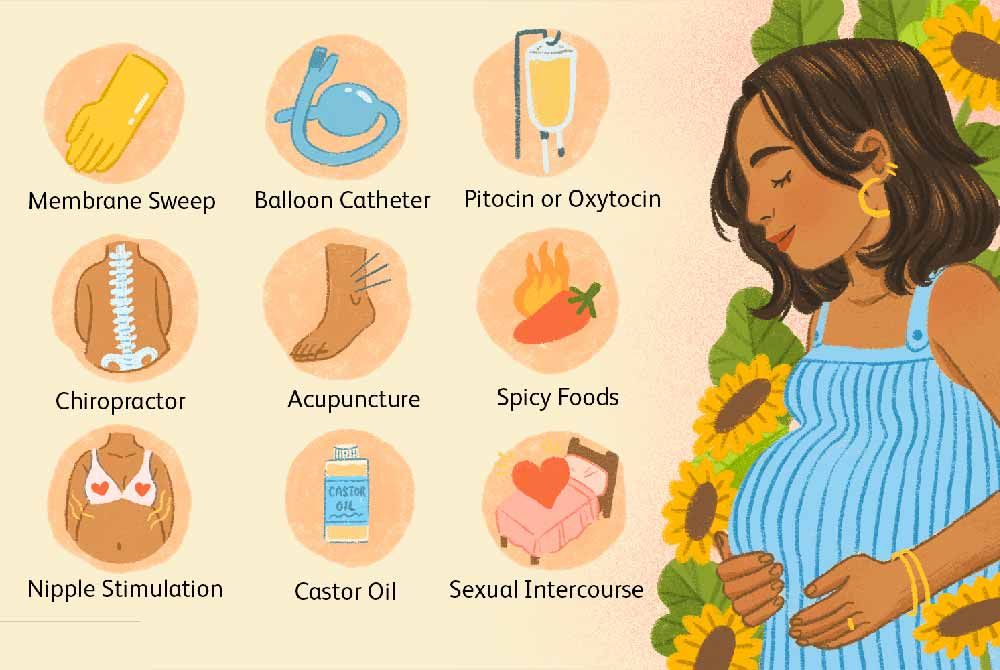 Coping with induced labor: Methods and considerations