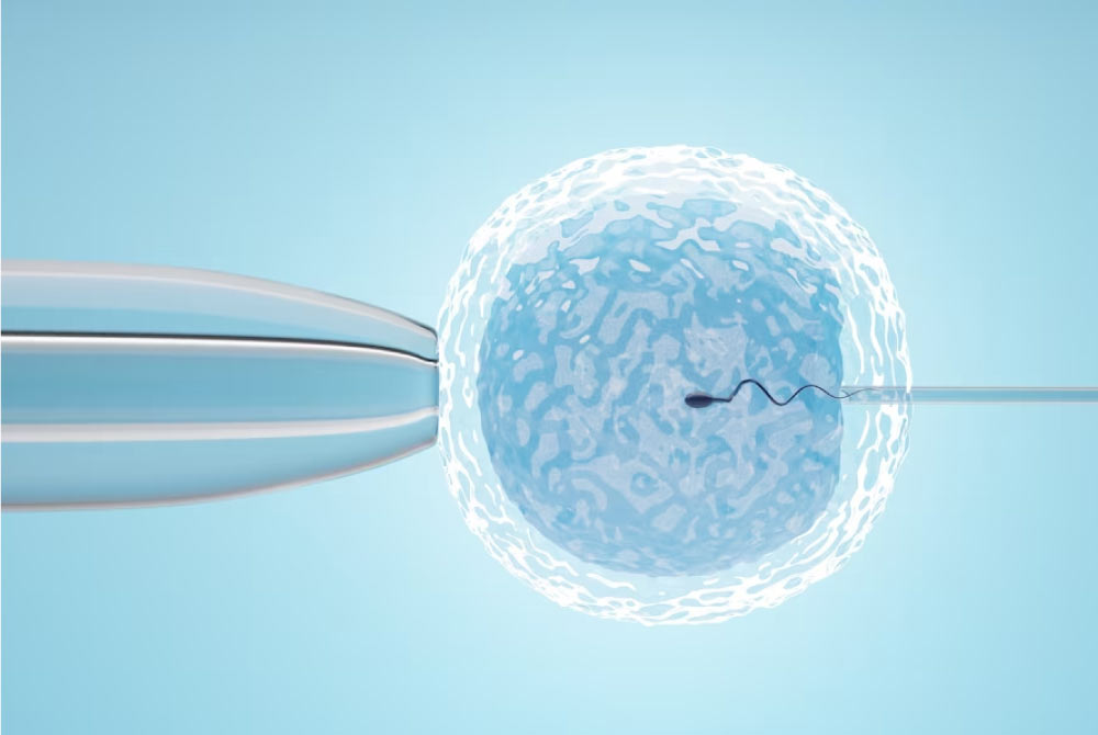 Debunking Common Myths and Misconceptions About IVF Treatment