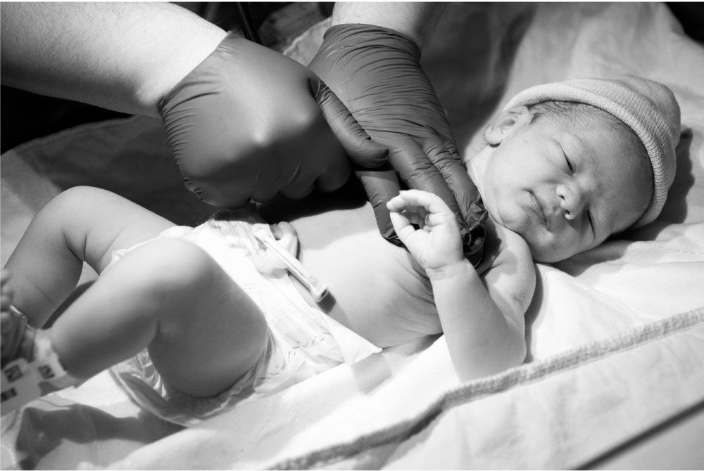 Feeding Challenges and Solutions for Premature Babies