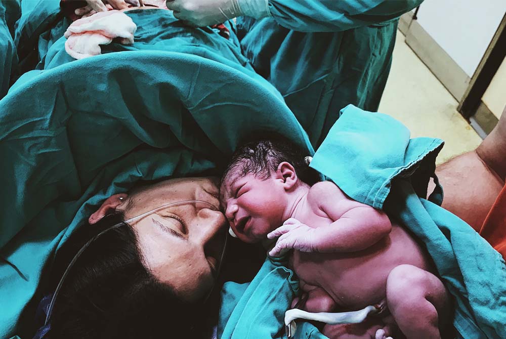 Navigating Vaginal Birth After Cesarean (VBAC): A Comprehensive Guide for Expectant Mothers