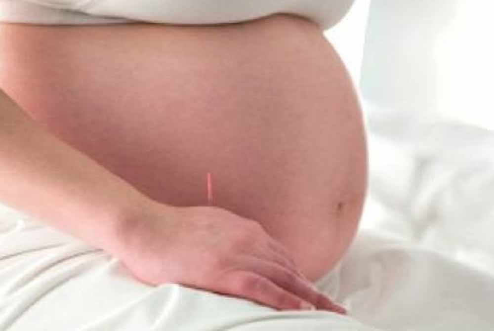 Pregnancy and the benefits of prenatal acupuncture for breech presentation