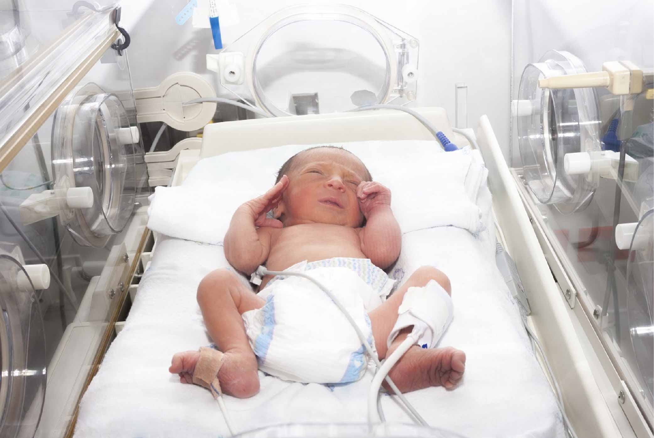 Premature Birth: Causes, Risk Factors, and Prevention