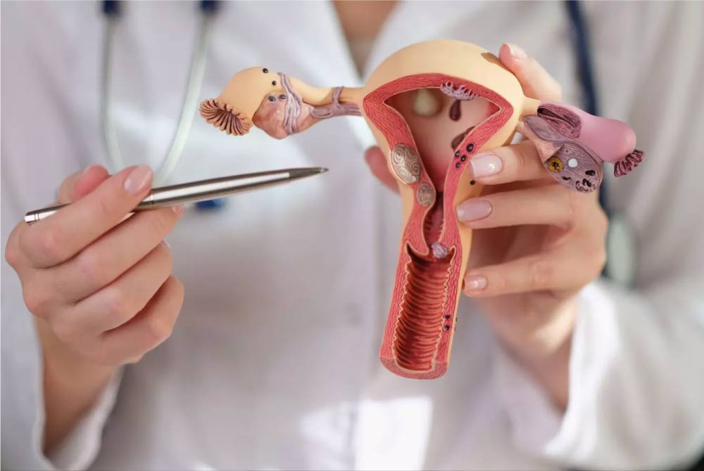 Risk of Hysterectomy After Endometrial Ablation
