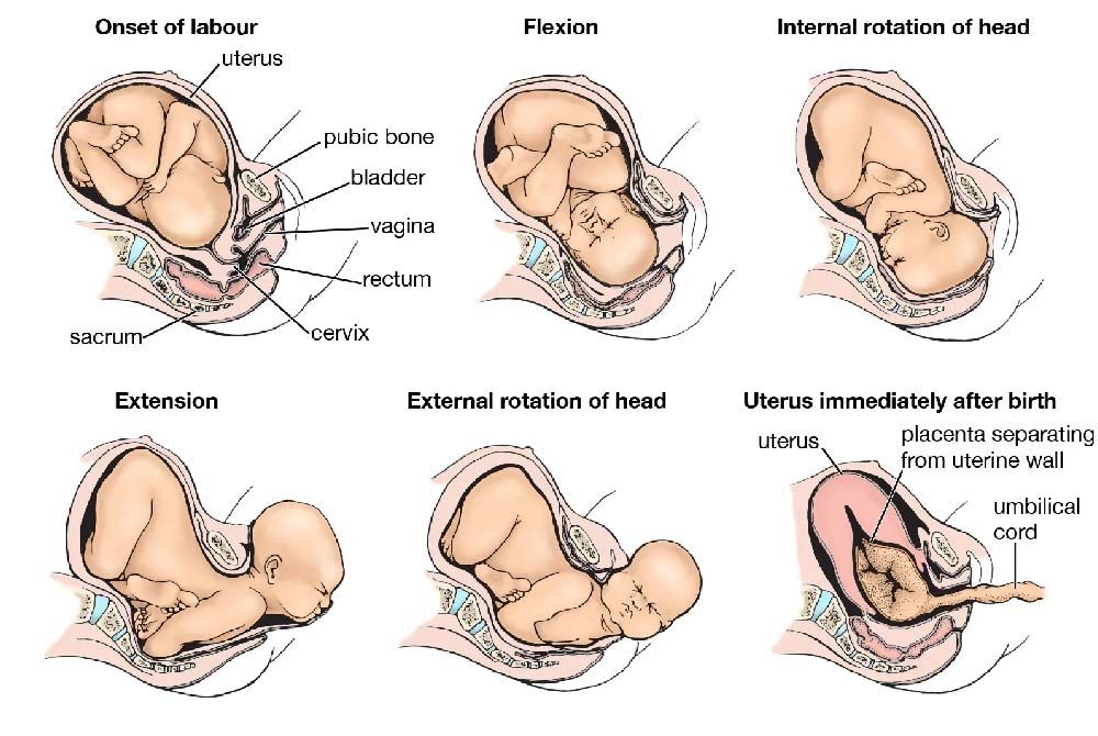 The impact of birth positions on labor and delivery