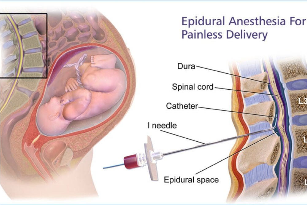 The best techniques for painless vaginal births