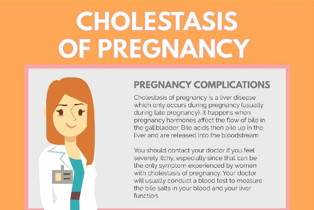 Understanding cholestasis of pregnancy: Symptoms, risks, and management