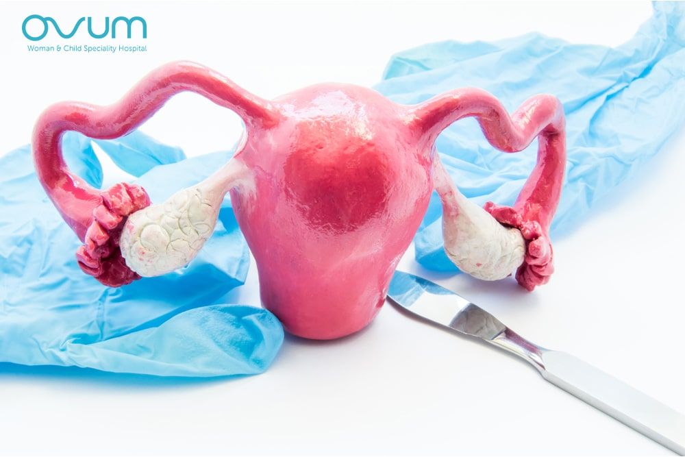 Role of Myomectomy in Achieving Successful Pregnancy