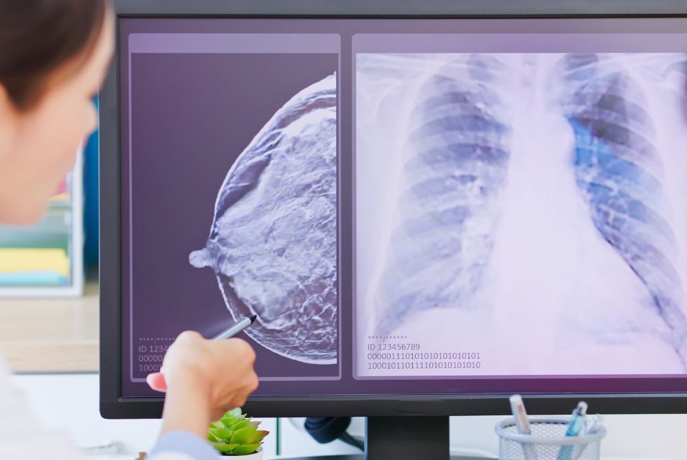 How Ultrasound Helps in Early Detection of Breast Cancer