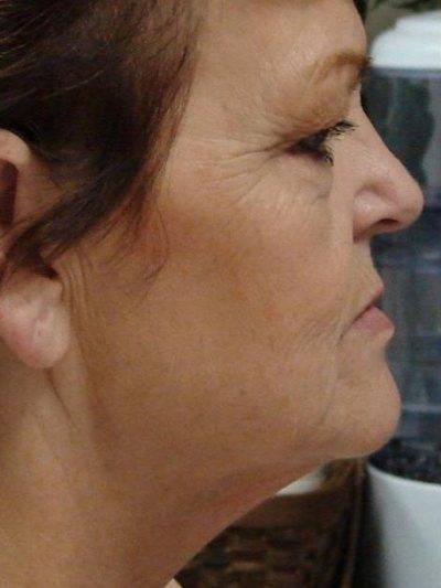 UNADJUSTEDNONRAW_thumb_20c