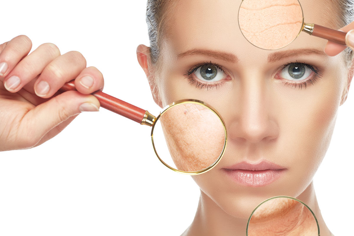 Featured image for: Is Sudocrem goed voor je gezicht?