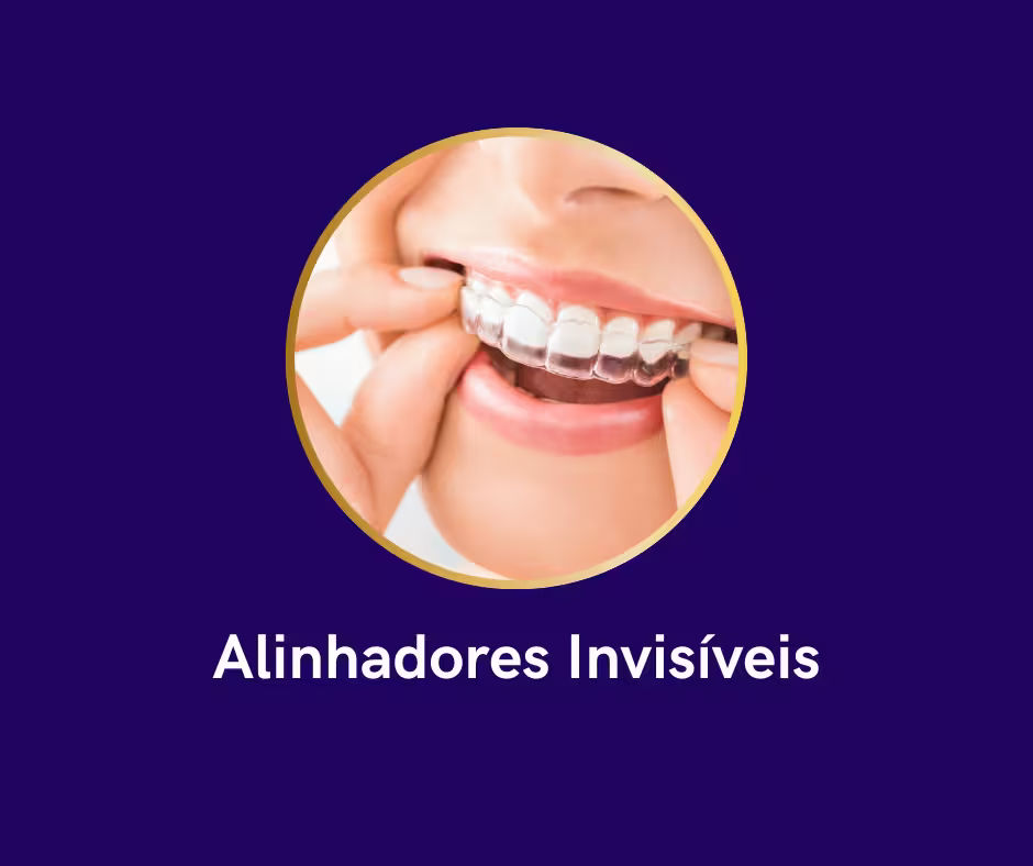 Alinhadores 1