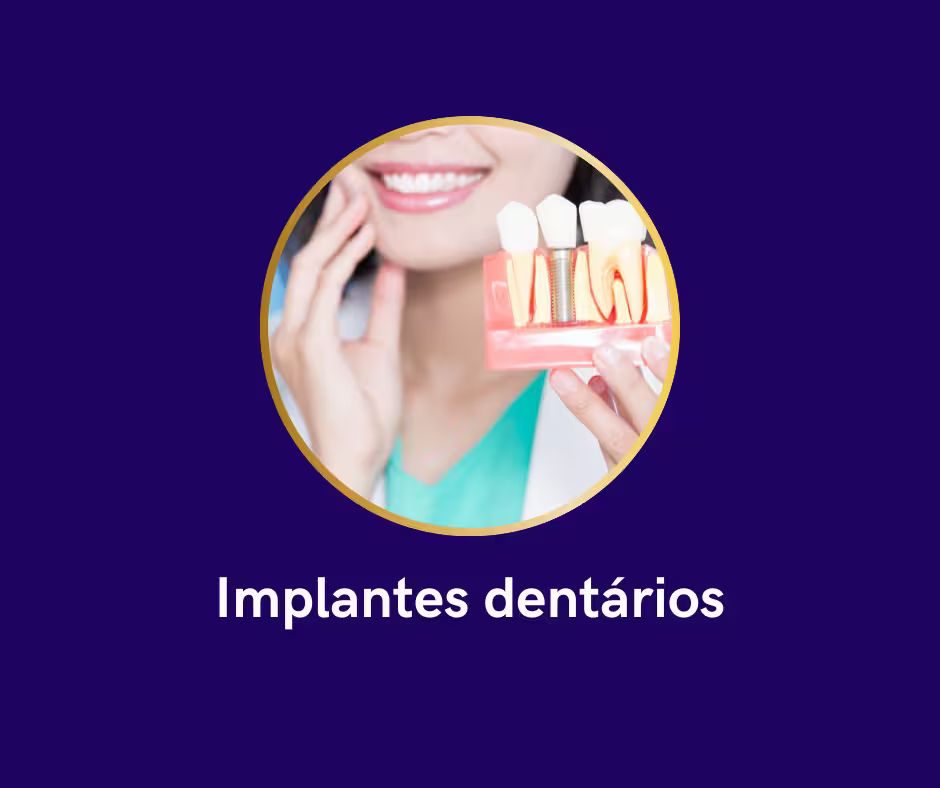 Implantes dentários