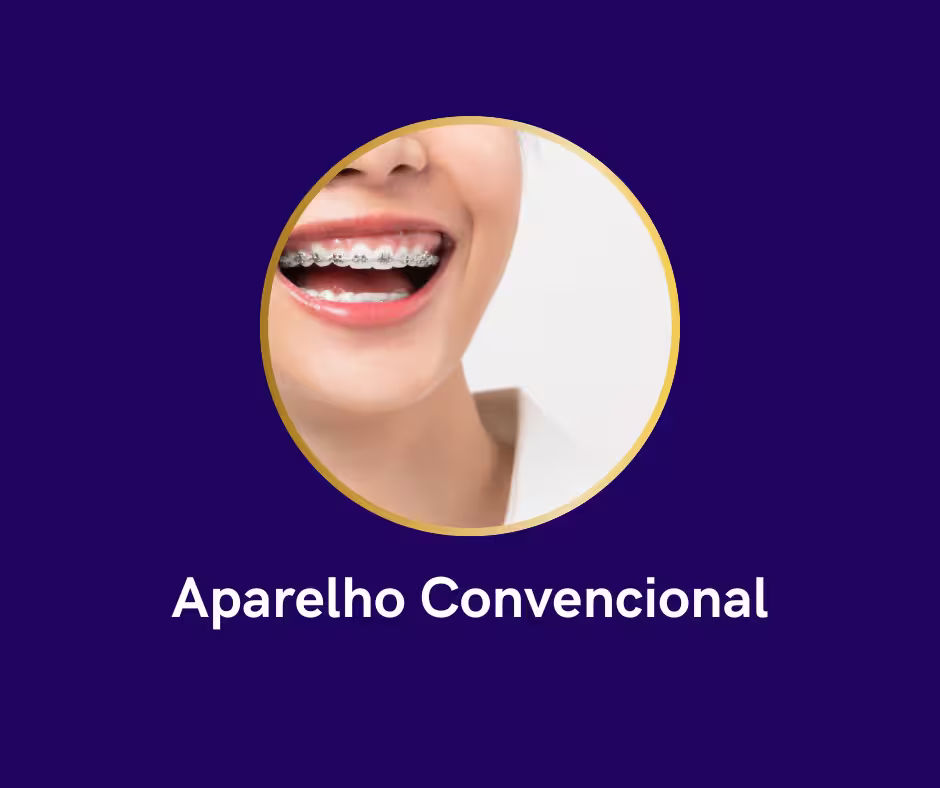 Aparelho convencional