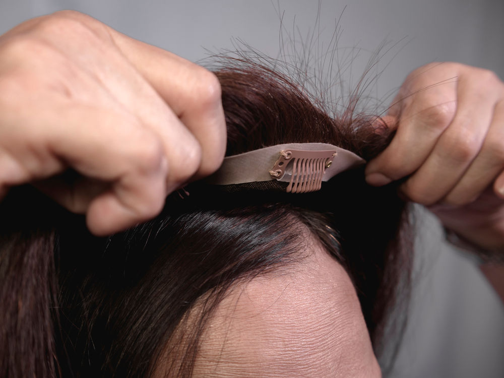 Scalp Topper