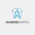 Diamond Whites Aligners 