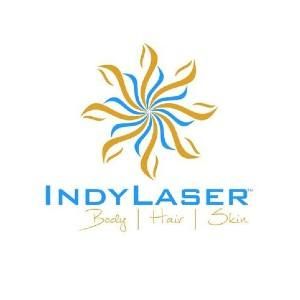 Indy Laser Coupons