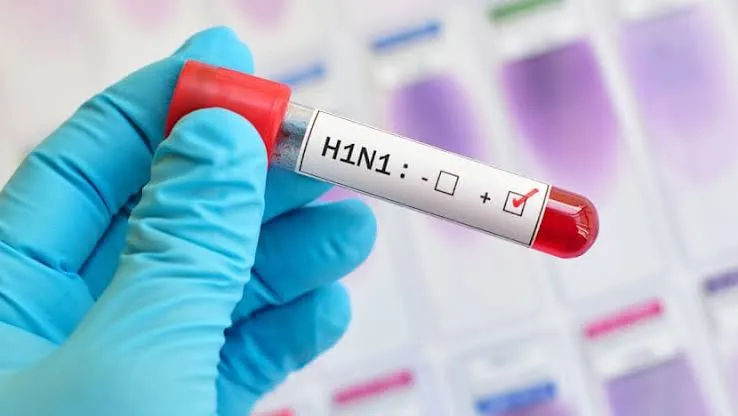 Mengenal 7 Gejala Influenza A dan Deretan Kelompok Rentannya