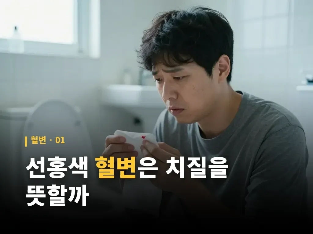 대장내시경 검사는 누구에게 필요할까 이미지