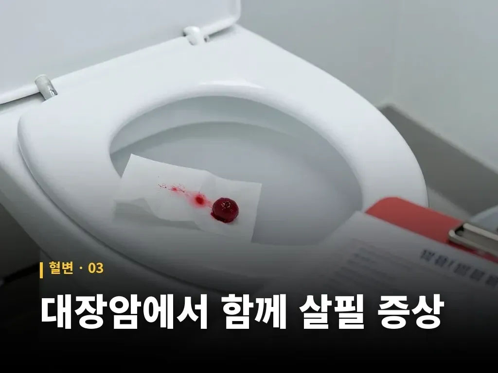 아이의 혈변과 응급 신호 이미지