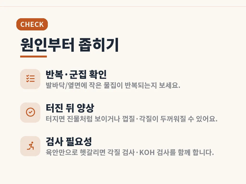 수포형 무좀과 습진 비교 이미지