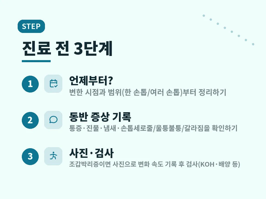 손톱 무좀 치료 방법과 선택 기준 이미지