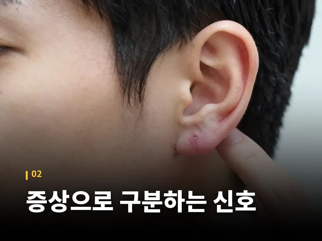 귀켈로이드수술 과정과 회복 흐름 이미지