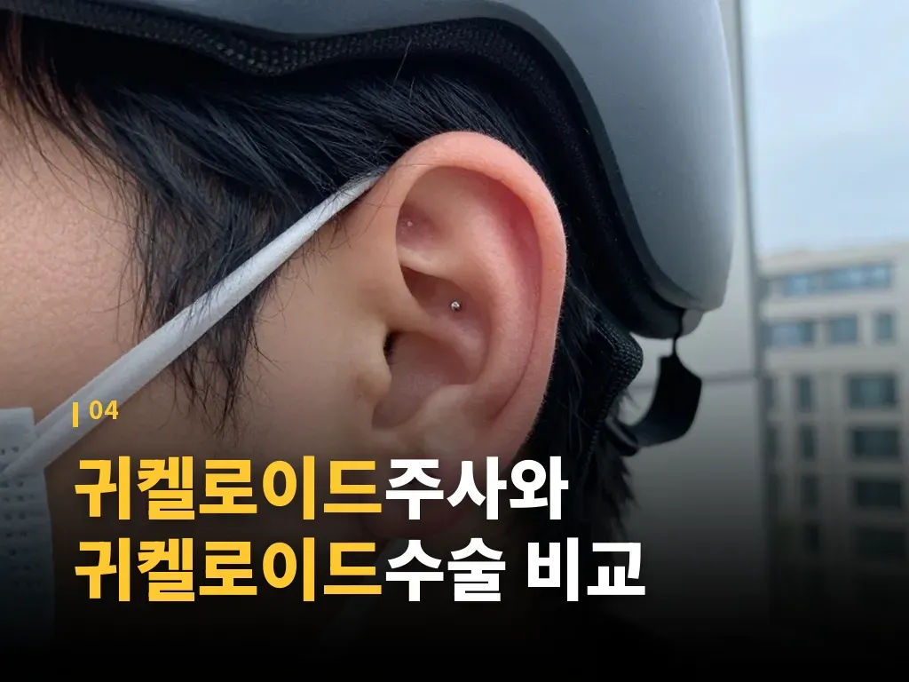 귀켈로이드병원 선택 기준 이미지