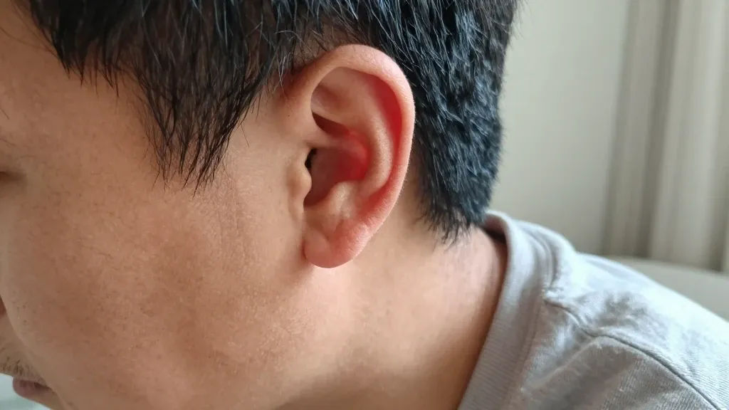귓볼주름 해결 단계와 관리법 이미지