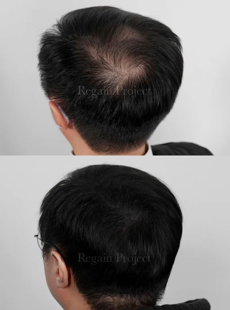 관련 이미지 1