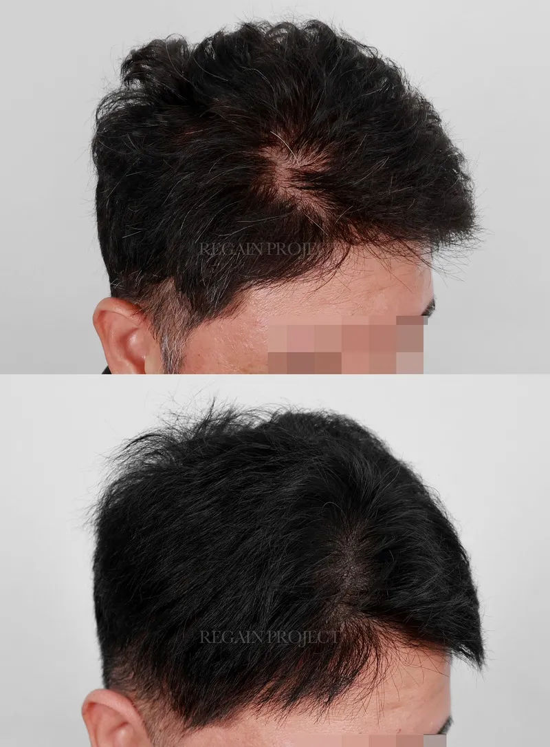 장단점 솔직 평가 이미지