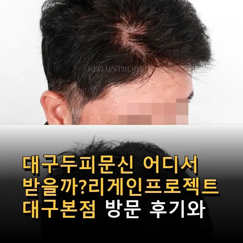 대구밀도보강 어디서 받지?어디가 잘하지? 리게인프로젝트 대구본점 방문 후기와 상세 정보