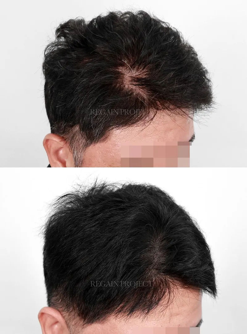 관련 이미지 1
