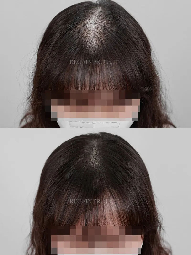 관련 이미지 1